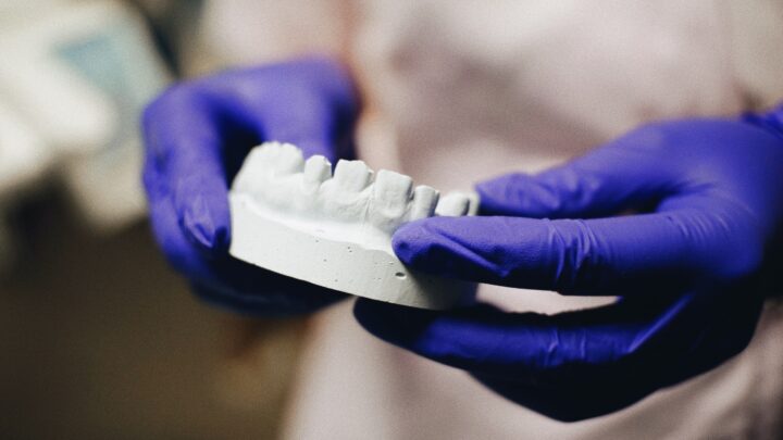 Sposoby na odbudowę zębów – protetyka Gliwice