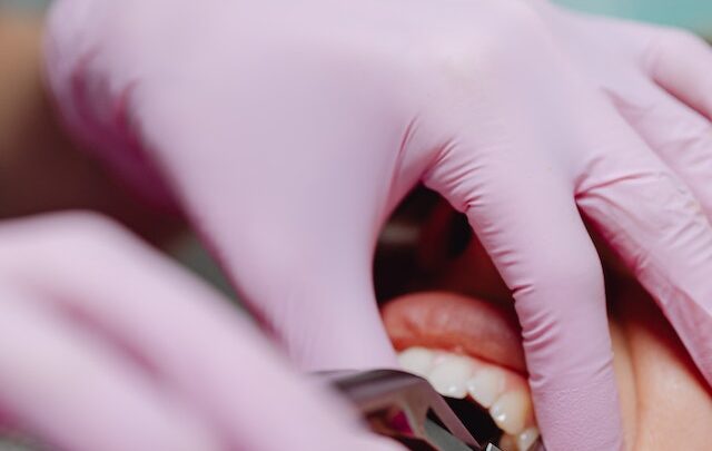 Nowoczesne trendy w protetyce – Innowacyjne protezy zębowe!