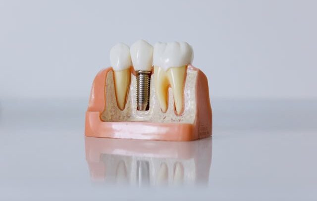 Konsultacja przed implantacją zęba – co obejmuje?