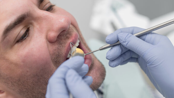 Jakie dodatkowe zabiegi mogą być potrzebne przy wszczepieniu implantów zębowych?