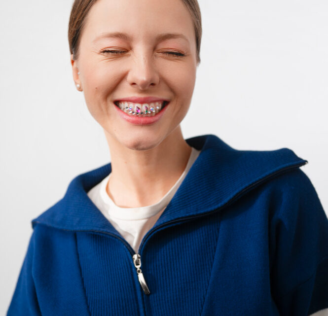 Czy aparat samoligaturujący prostuje wady zgryzu szybciej?